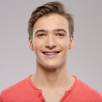 An Overview of the Different Types of Dental Braces for Teens and Adults