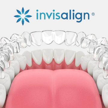 Your Complete Guide to the Invisalign Treatment Process